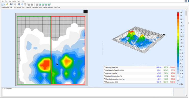 Pressure Mapping-Scan